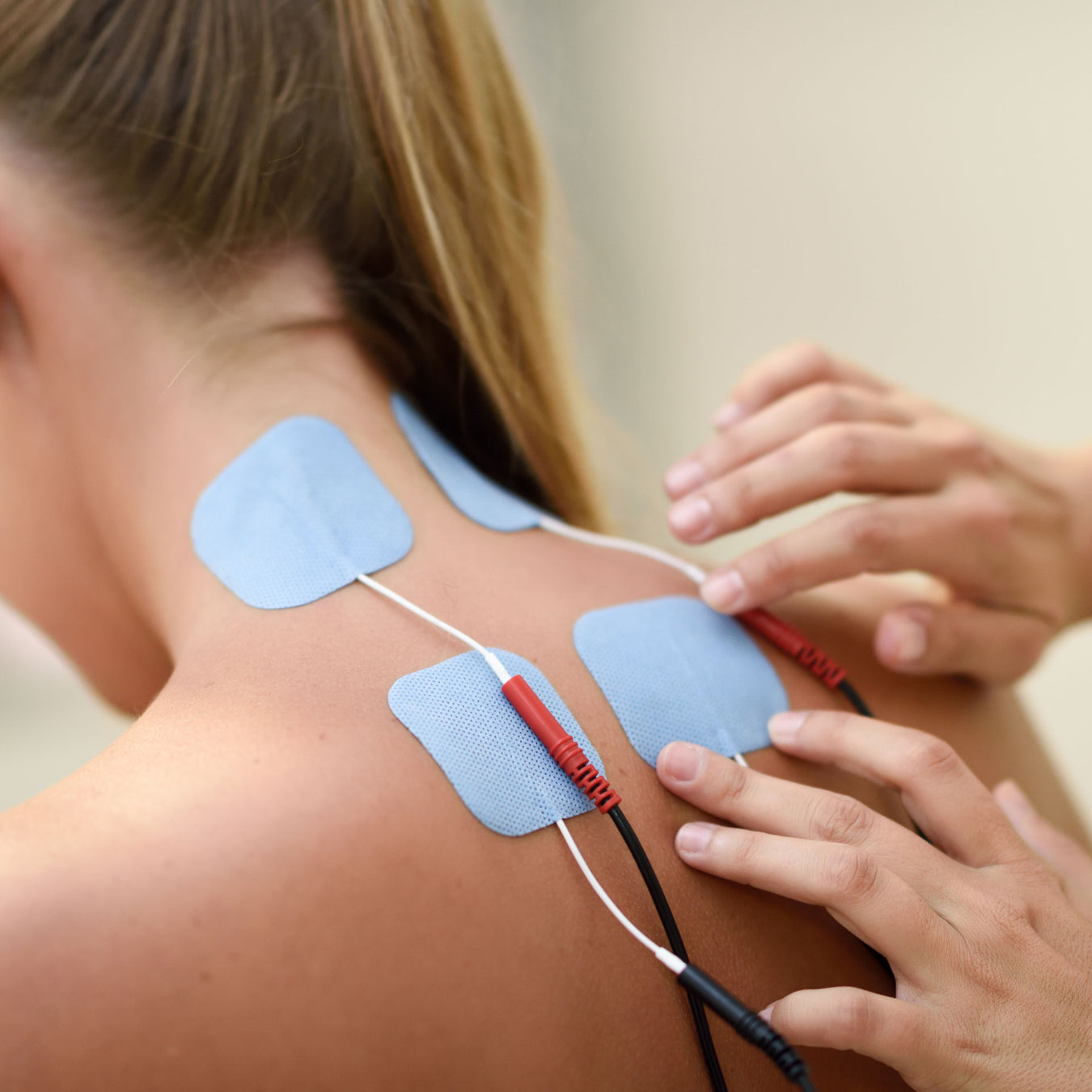 clinician applies electrodes to a woman patient's back for electrotherapy pain management