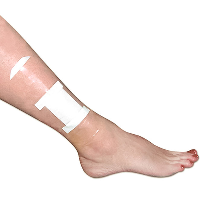 Brownmed SEAL-TIGHT Shield Wound Protector on a woman's ankle wound