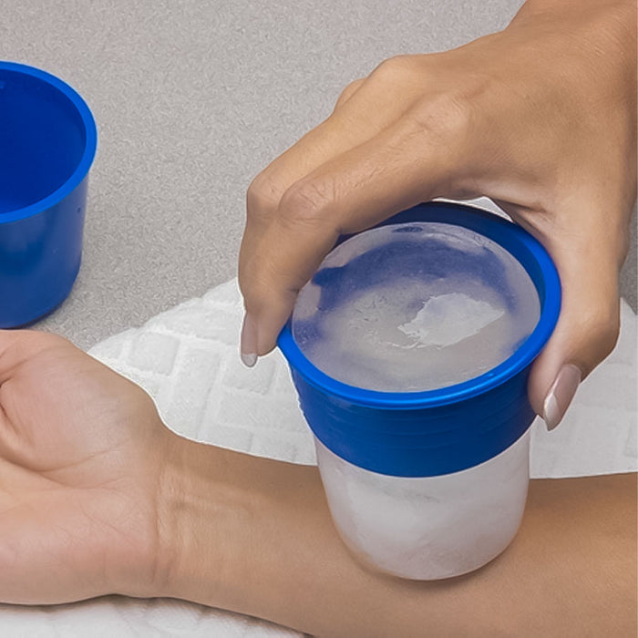 clinician using Cryocup Ice Massage Cup on patient's wrist